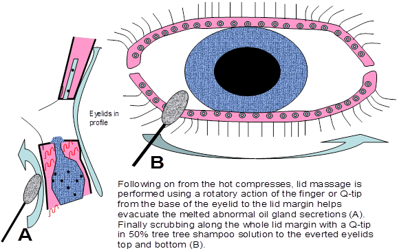 Eye Conditions | Eye Disorder and Diseases | Eyes Matter